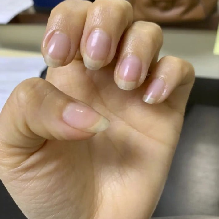Nails Growth Oil
