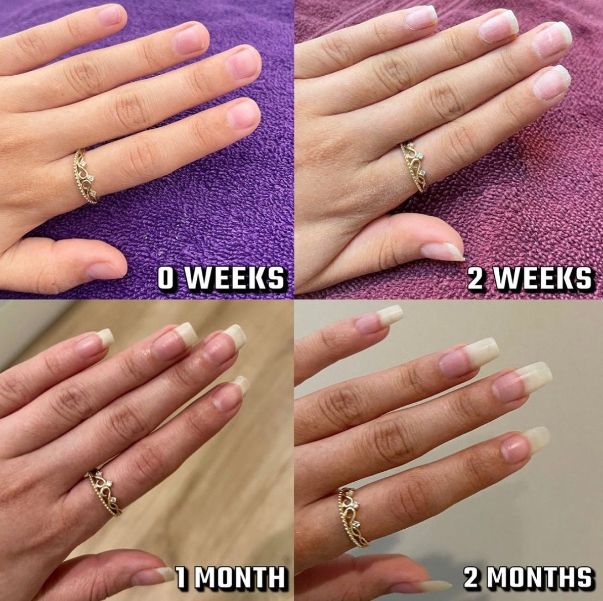 Nails Growth Oil