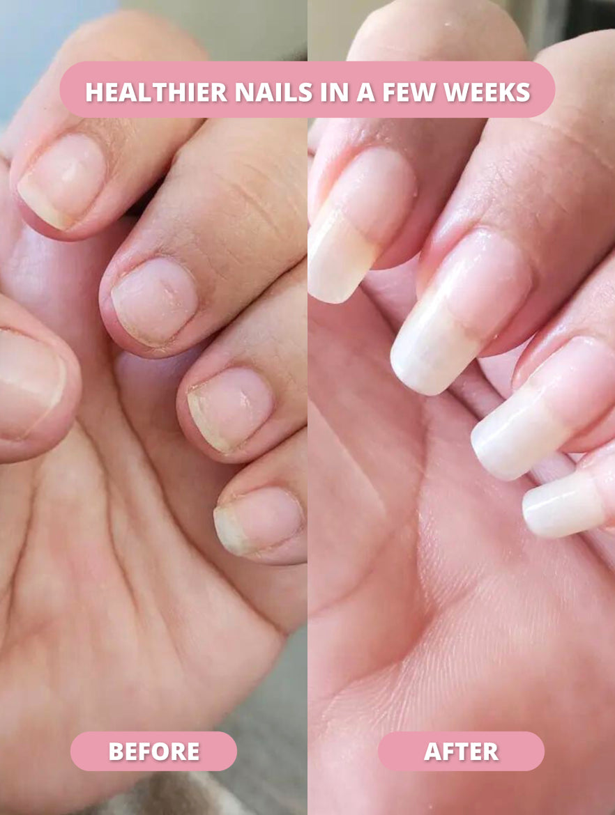 Stem Cell Nail Growth Pen