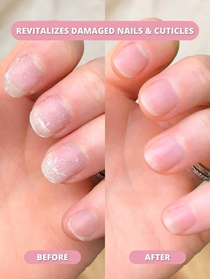 Stem Cell Nail Growth Pen
