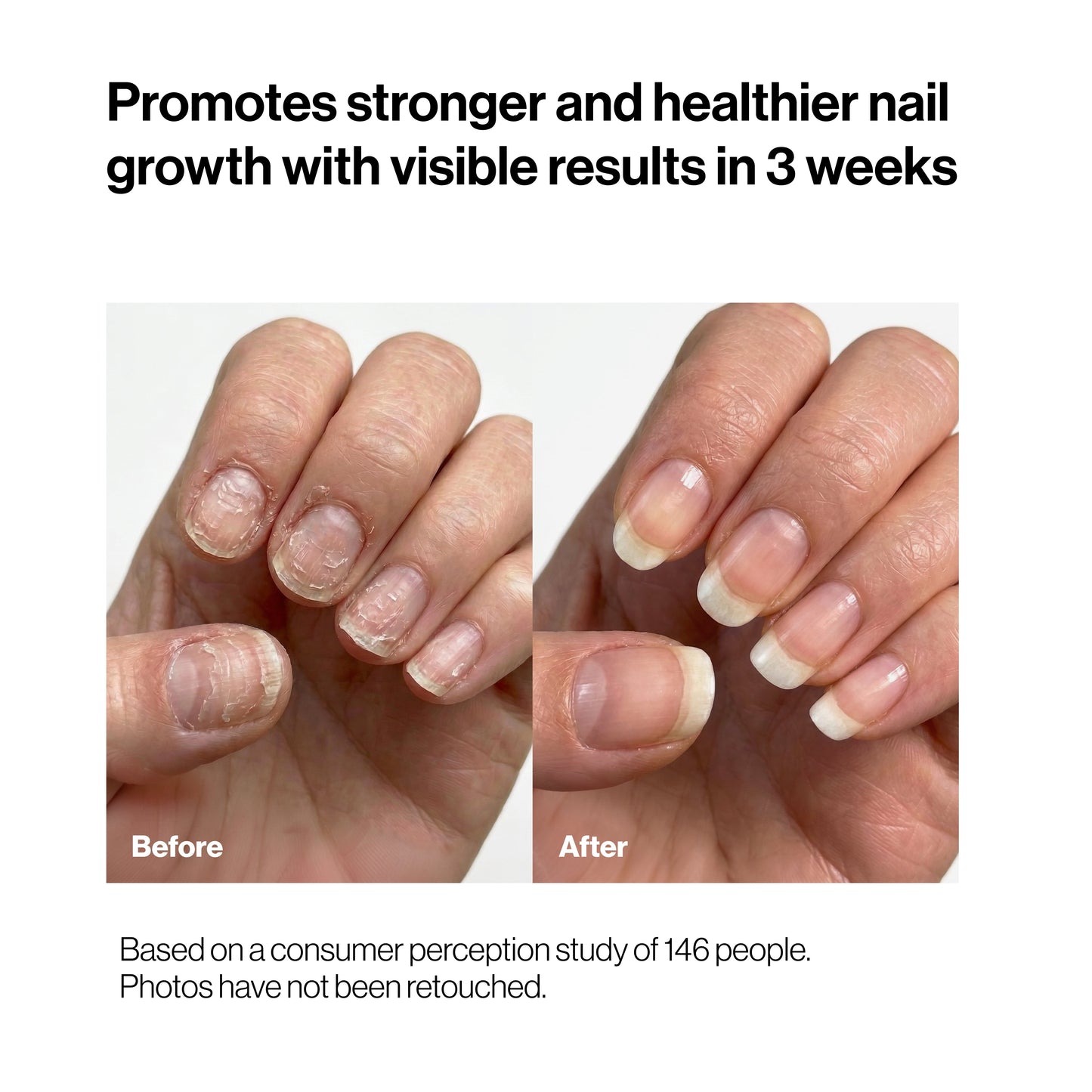 Nails Growth Oil