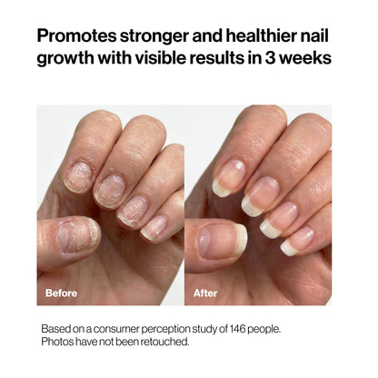 Nails Growth Oil