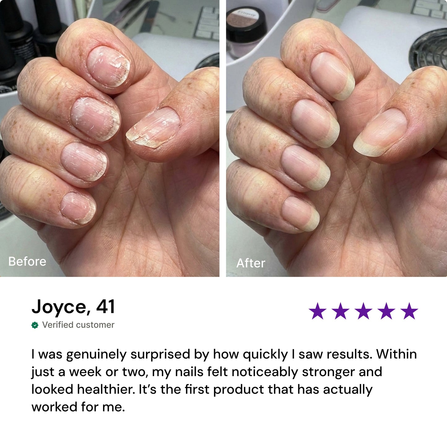 Nails Growth Oil